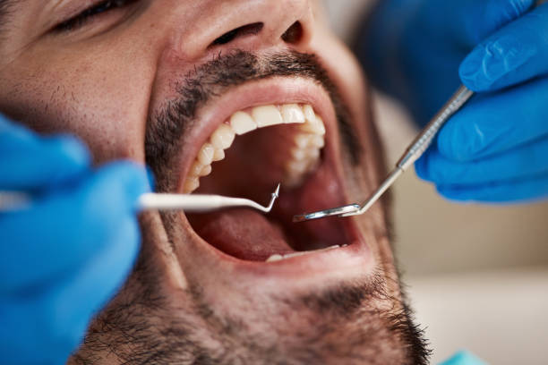 Best Emergency Treatment for Oral Infections in Jackson, CA